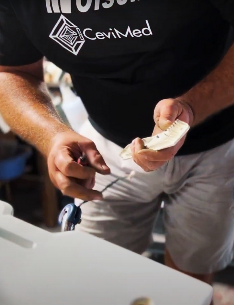 Replacement of Worn Parts